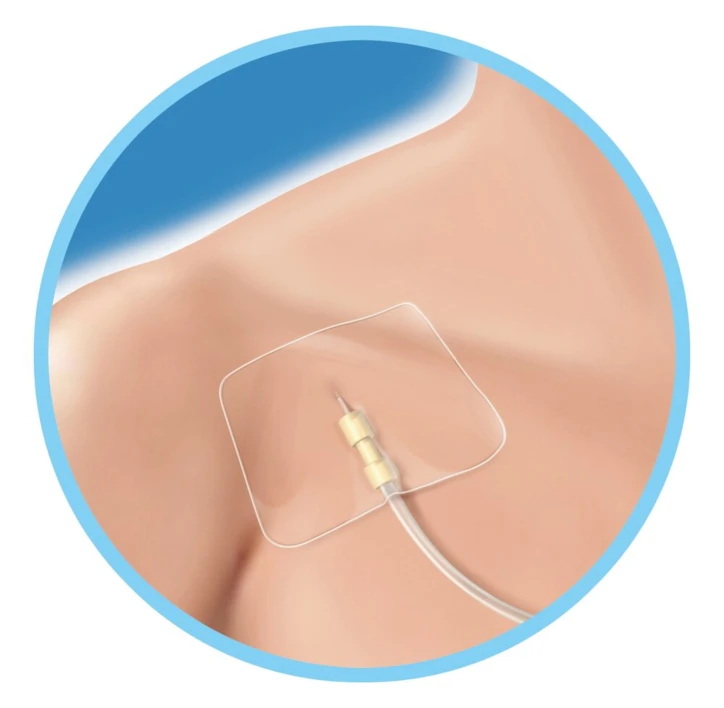 Pansement SECURFIX PLUS