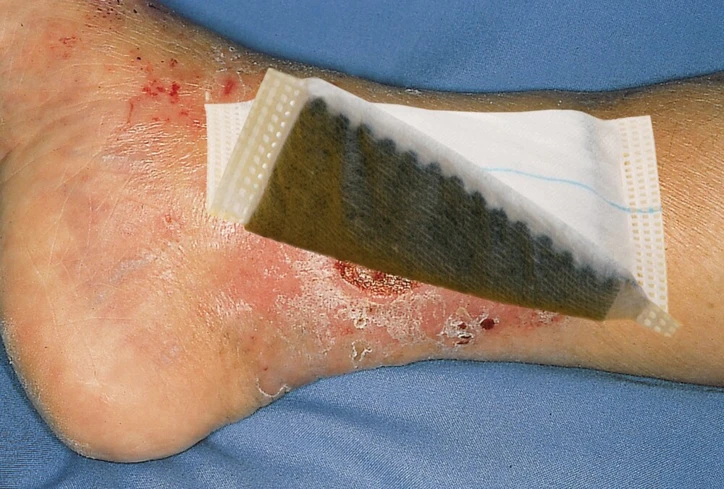 Pansement VLIWAKTIV® AG