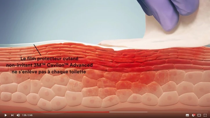 Film protecteur cutané haute résistance 3M™ Cavilon™ Advanced