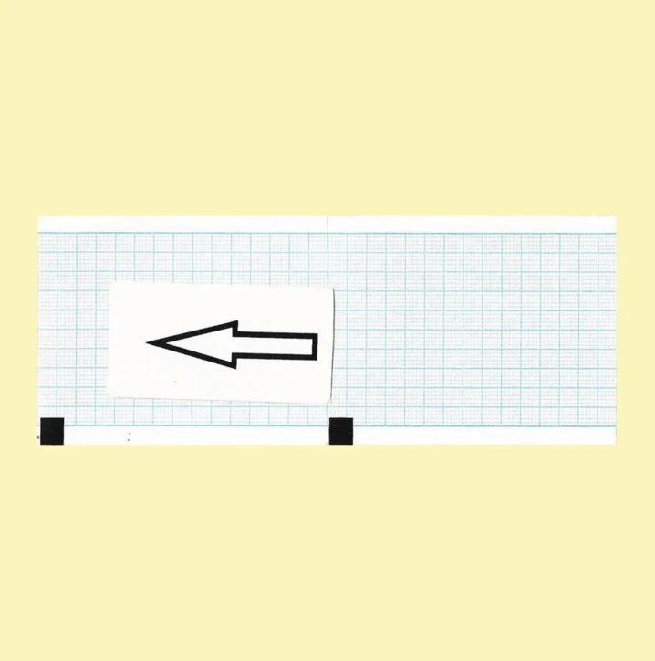 Paper ECG Cardiette - Colson - Cardiorapid