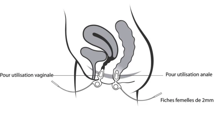 Sonde anale/vaginale ANUFORM® NEEN