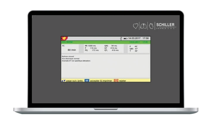 Logiciel d'interprétation ETM pour ECG Cardiovit AT-1 G2
