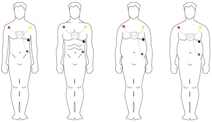 ECG 8-12 pistes