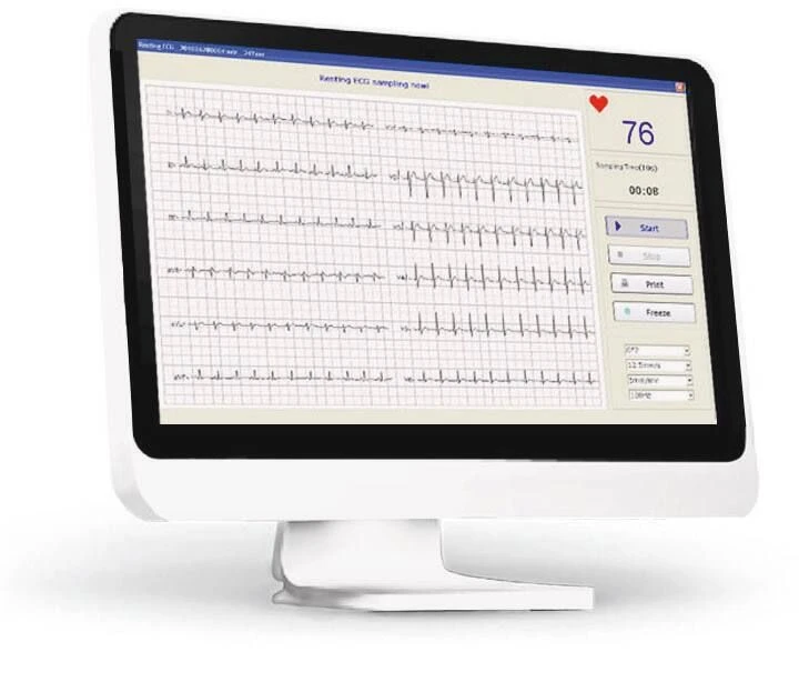 ECG numérique EDAN SE-1010