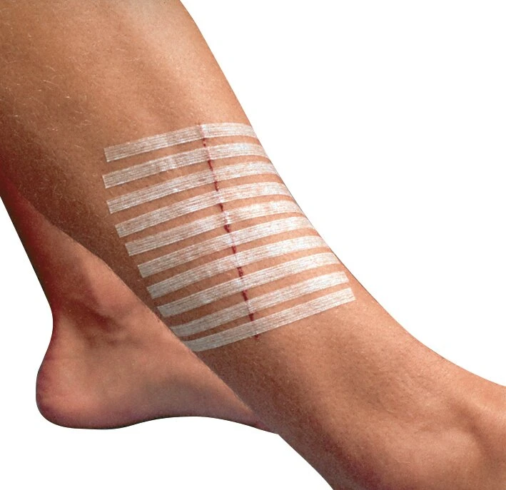 Suture 3M™ STERI-STRIP™