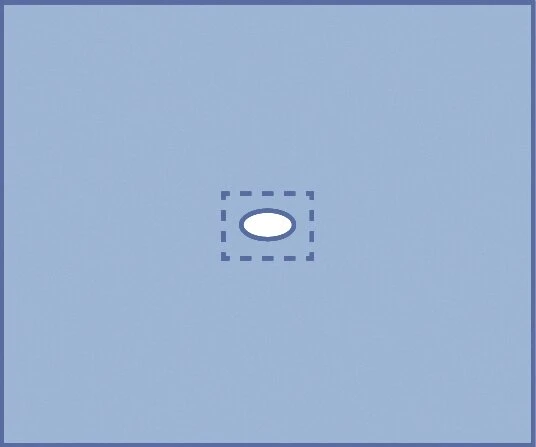 Champ de soins stérile*