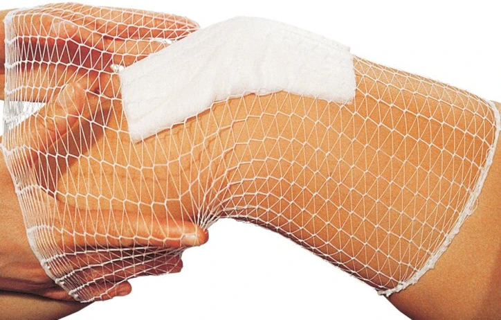 Filet tubulaire TG® FIX