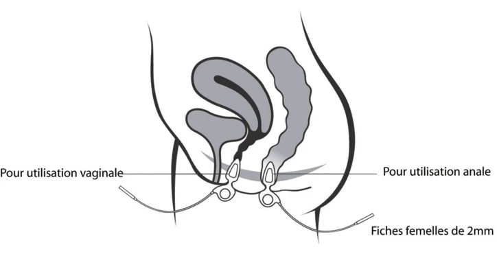 Sonde anale/vaginale ANUFORM® NEEN